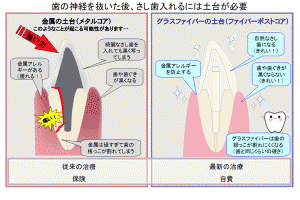 ファイバーコア